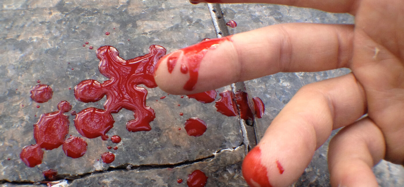 A Skater’s Guide to Dangerous and Deadly Pathogens